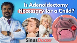 What are Adenoids  Causes  Symptoms  Is Adenoidectomy Necessary for a Child  SinusDoctor [upl. by Nnaed489]