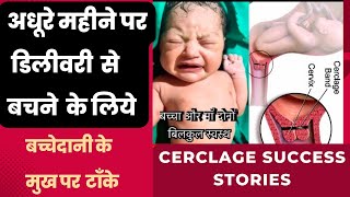 अधूरे महीने पर डिलीवरी से बचने के लिये गर्भाशय के मुख पर टाँके Dos amp Donts after Cerclage stitch [upl. by Notnerb]