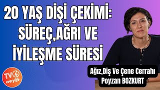 20 Yaş Dişi Çekimi Süreç Ağrı ve İyileşme Süresi [upl. by Suehtomit]