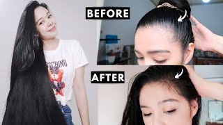 How I Grew Back My Hairline amp Prevent Receding Hairline [upl. by Richia]