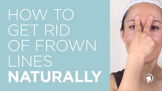 How to Get Rid of Frown Lines Naturally [upl. by Notsew]