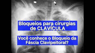 BLOQUEIO do plano da FÁSCIA CLAVIPEITORAL  UltrasoundGuided CLAVIPECTORAL Fascial Plane BLOCK [upl. by Trent794]