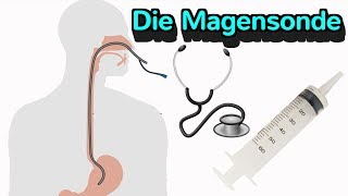 Alles wissenswerte zur Magensonde [upl. by Acinorrev]