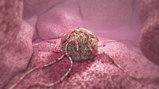 360° Tumor Death Animation demo [upl. by Naoh]