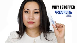 WHY I STOPPED USING DIFFERIN GEL  ADAPALENE GEL 01 ACNE TREATMENT  Zulayla [upl. by Lac740]