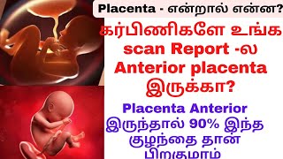 palaceta meaning tamilanterior placentaanterior placenta during pregnancy in tamil [upl. by Constanta]