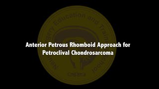 Anterior Petrous Rhomboid Approach for Petroclival Chondrosarcoma [upl. by Janelle]