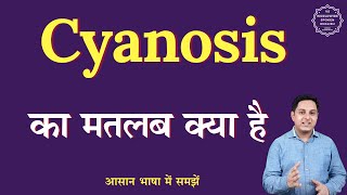 Cyanosis meaning in Hindi  Cyanosis ka matlab kya hota hai  English to hindi [upl. by Enirol]