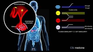 4 Effects of Hyperglycemia 1 [upl. by Stucker]