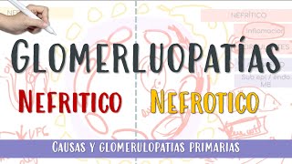 GLOMERULOPATIAS Nefrotico Nefritico GNRP Membranosa GNPE FocalySegmentaria Glomerulonefritis [upl. by Holland770]