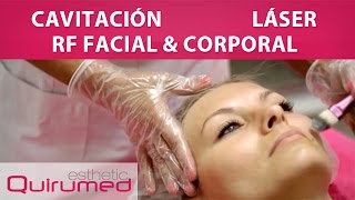 Cavitación  Radiofrecuencia Facial y Corporal  Láser [upl. by Elleirb]