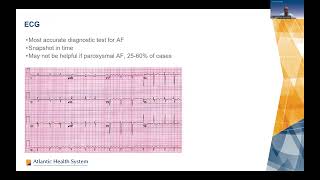 Advances in Diagnosis and Management of Atrial Fibrillation [upl. by Teddie]