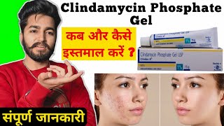 Clindamycin Gel Uses and Side Effects  Clindamycin Gel Review Clindac A Gel [upl. by Broderic]