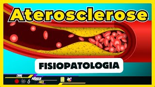 Aterosclerose Patogenia Fisiopatologia e tipos  Resumo Patologia 2024 [upl. by Blondell]