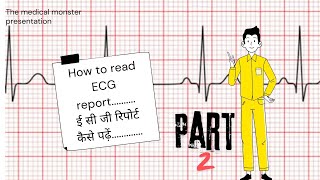 How to read ECG report in hindi part 2 [upl. by Tipton]