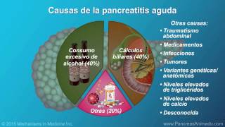 Pancreatitis aguda [upl. by Karia249]