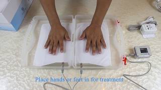 Iontophoresis machine for hyperhidrosis hands and feet  Iontocure latest device iD200 demo [upl. by Yarb]