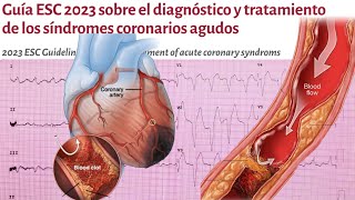 INFARTO AGUDO MIOCARDIO GUIA ESC 2023 SINDROMES CORONARIOS [upl. by Gnik]