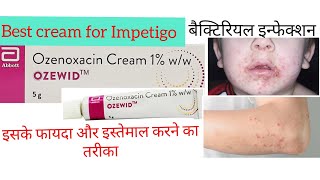 Ozenoxacin cream review Benefits  How to use amp side effects  Best cream for Impetigo  Skin inf [upl. by Uolymme]