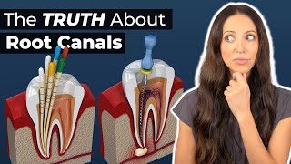 What to Expect During a Root Canal Procedure [upl. by Ssenav982]