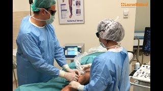 Varice  tratament cu laser endovenos 360 grade [upl. by Anauj63]