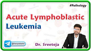 15 Acute Lymphoblastic Leukemia ALL  USMLE Step 1 Pathology [upl. by Rusert]