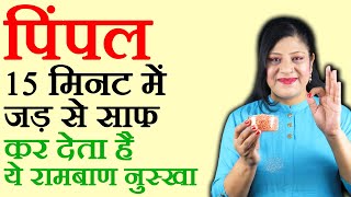 पिंपल के घरेलू नुस्खे pimple kaise hataye pimple ka ilaj muhase ka ilaj How To Cure Pimples [upl. by Treat]