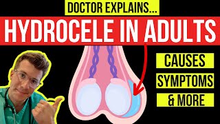 What is a HYDROCELE Doctor explains causes symptoms and treatment including surgery [upl. by Oiramel]