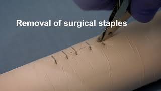 Placing and removing surgical wound closure staples [upl. by Thompson]