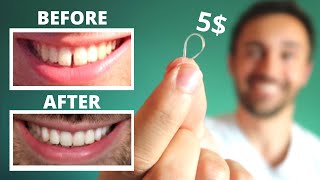 DIY CLOSE GAP TEETH AT HOME  My Update [upl. by Haelhsa]