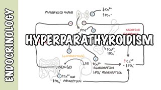 Hyperparathyroidism and the different types causes pathophysiology treatment [upl. by Kralc]