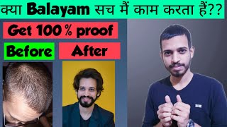 क्या Balayam सच मैं काम करता हैंIts truth  Regrowth Receding Hairline naturally [upl. by Yrem]