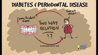 Diabetes and periodontitis The two way relationship [upl. by Dohsar]