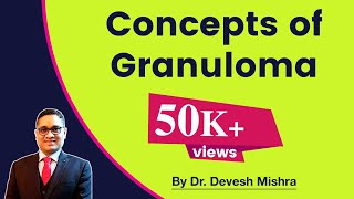 Granuloma by Dr Devesh Mishra [upl. by Childs]