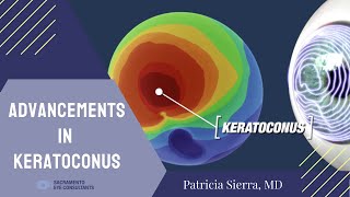 Advancements in technology to treat Keratoconus [upl. by Anneiv]