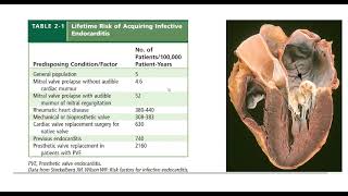 Infective endocarditis  General medicine  DrKarrar Abdulzahra [upl. by Malda]