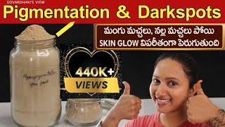 Pigmentation treatment on face at home in Telugu  Melasma Dark Spots amp Acne Spots Govardhani [upl. by Janetta]