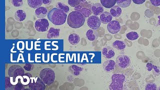 Leucemia cómo y qué es este cáncer [upl. by Rebmak84]