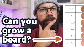 How to know if you can grow a beard  4 simple checks [upl. by Sewel658]