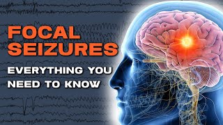 The Truth About Focal Automatism Seizures [upl. by Arykat]