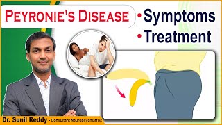 What is The Best Treatment for Peyronies Disease  Peyronies Shockwave Treatment  ED Cure [upl. by Catt]