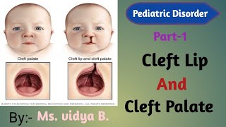 Cleft lip and cleft palate  causes  symptoms  diagnostic test  treatment  pediatrics nursing [upl. by Casie]