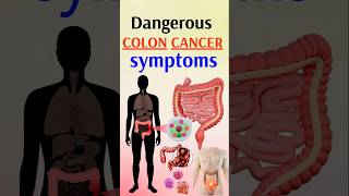 Cancer Symptoms You Should NEVER Ignore [upl. by Narhem510]