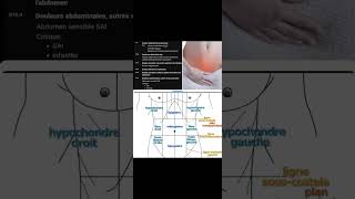 R10 Douleur abdominale et pelvienne [upl. by Nalepka]