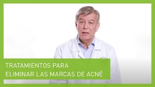 Cómo eliminar las cicatrices del acné  BIODERMA [upl. by Leblanc318]