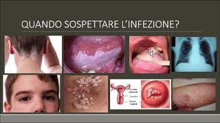 Kit per irrigazione a goccia Claber  Come si installa [upl. by Assirk]