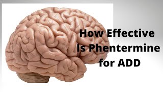 How Effective Is Phentermine for ADD [upl. by Aerdnaxela]