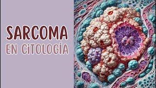 Sarcoma en citología [upl. by Atinna]