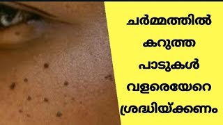 Be Careful of Dark Spots on the Skin  MALAYALAM  ROCK BULL MEDIA [upl. by Renaldo740]