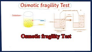 Osmotic Fragility Test  Dacies and Sanford method [upl. by Xavler686]